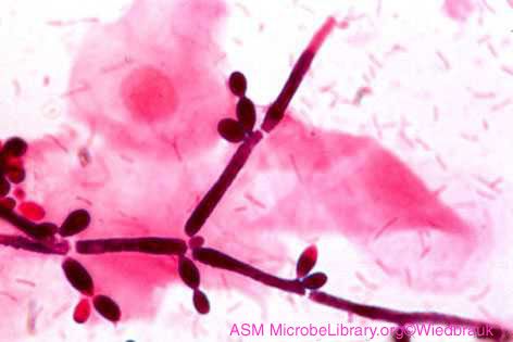 Candida-Pilze (Candida) - Erreger der Candidose Candida-Pilze (Candida) - Erreger der Candidose