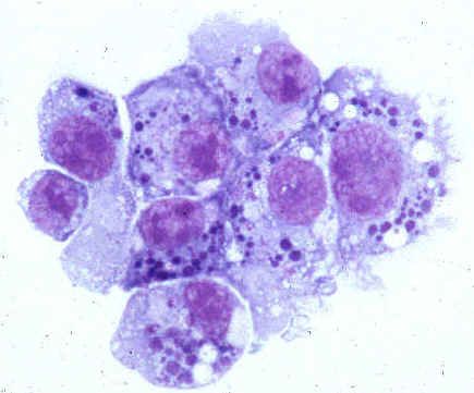Erreger der menschlichen Anaplasmose (Familie Anaplasmataceae)