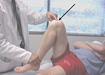 Knieschmerzen beim Beugen sind der häufigste Grund, warum Menschen einen Traumatologen aufsuchen.